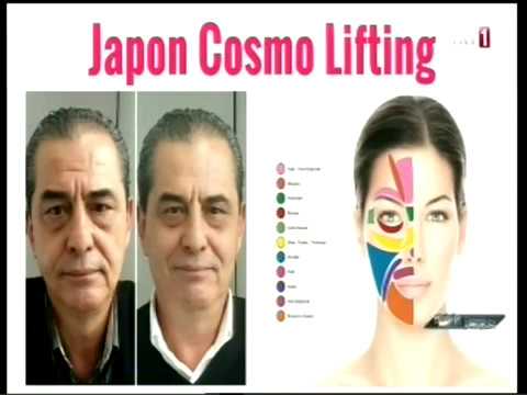 Japon Cosmo Lifting ile Kırışıklık Tedavisi (TRT 1 - İyi Fikir Programı)